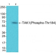 Mitogen-Activated Protein Kinase Kinase Kinase 7 Phospho-Thr184 (TAK1 pT184) Antibody