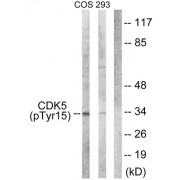 Cyclin-Dependent-Like Kinase 5 Phospho-Tyr15 (CDK5 pY15) Antibody