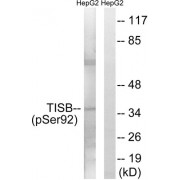 Western blot analysis of extracts from HepG2 cells, using TISB (Phospho-Ser92) antibody.