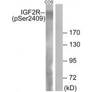 Western blot analysis of extracts from COS-7 cells, treated with UV (15mins), using IGF2R (Phospho-Ser2409) antibody.