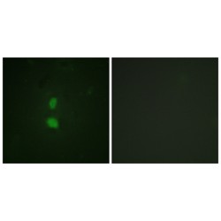 SNAI1 (Phospho-Ser246) Antibody