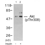 Western blot analysis using Akt (Phospho-Thr308) Antibody. Line1: The extracts from 293 cells untreated; Line2. The extracts from 293 cells treated with insulin.