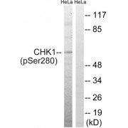 Western blot analysis of extracts from HeLa cells, using CHK1 (phospho-Ser280) antibody.