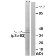 Western blot analysis of extracts from HeLa cells, using c-Jun (Phospho-Ser63) antibody.