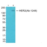 Western blot analysis of extracts from HepG2 cells, using Receptor Tyrosine-Protein Kinase ErbB-2 Phospho-Tyr1248 (ERBB2 pY1248) Antibody. Lane 1 is blocked with phospho-peptide.
