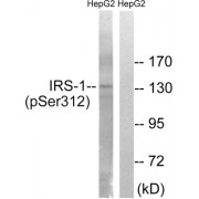 Western blot analysis of extracts from HepG2 cells, using IRS-1 (Phospho-Ser312) antibody.