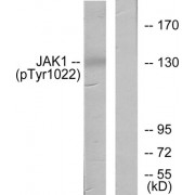 Western blot analysis of extracts from A549 cells, using JAK1 (Phospho-Tyr1022) antibody.