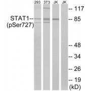 Western blot analysis of extracts from 293 cells, 3T3 cells treated with UV (15mins) and Jurkat cells treated with eto (25uM, 24hours), using STAT1 (Phospho-Ser727) antibody.