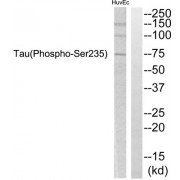 Western blot analysis of extracts from HuvEc cells, using Tau (Phospho-Ser235) Antibody.