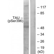 Western blot analysis of extracts from HeLa cells, using Tau (Phospho-Ser396) Antibody.