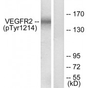 Western blot analysis of extracts from HepG2 cells, treated with Na3VO4 (0.3nM, 40mins), using KDR pY1214 antibody.