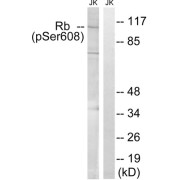 Western blot analysis of extracts from Jurkat cells, treated with PMA (125ng/ml, 30mins), using Retinoblastoma (Phospho-Ser608) antibody.