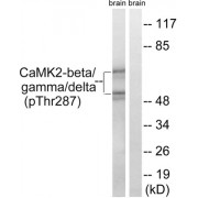 Western blot analysis of extracts from rat brain cells, using CaMK2-beta/gamma/delta (Phospho-Thr287) antibody.