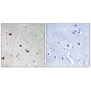 Immunohistochemistry analysis of paraffin-embedded human brain tissue using IKK- gamma (Phospho-Ser376) antibody.