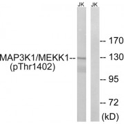 Western blot analysis of extracts from Jurkat cells, using MAP3K1 (Phospho-Thr1402) antibody.