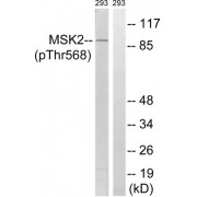 Western blot analysis of extracts from 293 cells, treated with H2O2 (100uM, 15mins), using MSK2 (Phospho-Thr568) antibody.