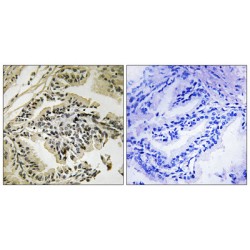 PEK / PERK (Phospho-Thr981) Antibody
