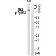 Western blot analysis of extracts from HepG2, using+.