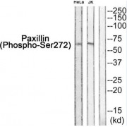 Western blot analysis of extracts from HeLa and JK, using Paxillin++.