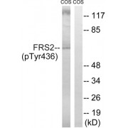 Western blot analysis of extracts from COS cells, using FRS2 (Phospho-Tyr436) antibody.