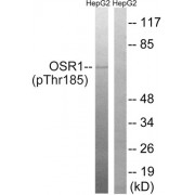 Western blot analysis of extracts from HepG2 cells, treated with serum (20%, 15mins), using OSR1 (Phospho-Thr185) antibody.