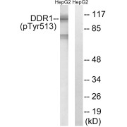 Western blot analysis of extracts from HepG2 cells, using DDR1 pY513 Antibody. The lane on the right was treated with Na3VO4 and a P-peptide whereas the lane on the left was treated only with Na3VO4.