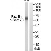 Western blot analysis of extracts from HT-29, using Paxillin++.