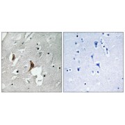 Immunohistochemistry analysis of paraffin-embedded human brain tissue using NMDAR2B (Phospho-Tyr1336) antibody.