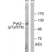 Western blot analysis of extracts from 3T3 cells, using PYK2 (Phospho-Tyr579) antibody.