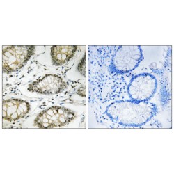 Serine/Threonine-Protein Kinase ATR Phospho-Ser428 (ATR pS428) Antibody