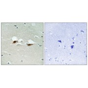 Immunohistochemistry analysis of paraffin-embedded human brain tissue using ATF2 (Phospho-Ser472) antibody.