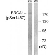 Western blot analysis of extracts from 293 cells, treated with epo (20U/ml, 15mins), using BRCA1 (Phospho-Ser1457) antibody.
