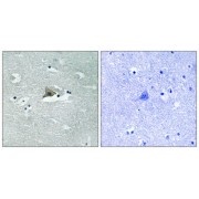 Immunohistochemistry analysis of paraffin-embedded human brain tissue using Claudin 5 (Phospho-Tyr217) antibody.