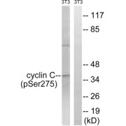 Western blot analysis of extracts from 3T3 cells, treated with UV (15mins), using Cyclin C (Phospho-Ser275) antibody.