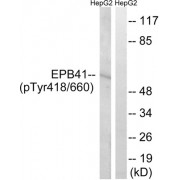 Western blot analysis of extracts from HepG2 cells, treated with PMA (125ng/ml, 30mins), using EPB41 (Phospho-Tyr660/418) antibody.
