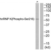 Western blot analysis of extracts from JurKat cells, using hnRNP K (Phospho-Ser216) antibody.