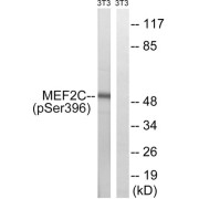 Western blot analysis of extracts from 3T3 cells, treated with starved (24hours), using MEF2C (Phospho-Ser396) antibody.