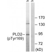Western blot analysis of extracts from Jurkat cells, treated with TNF (20ng/ml, 30mins), using PLD2 (Phospho-Tyr169) antibody.