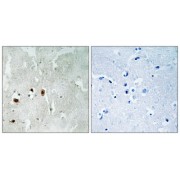 Immunohistochemistry analysis of paraffin-embedded human brain tissue using Tip60 (Phospho-Ser90) antibody.
