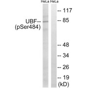 Western blot analysis of extracts from HeLa cells, treated with calyculinA (50ng/ml, 30mins), using UBF (Phospho-Ser484) antibody.