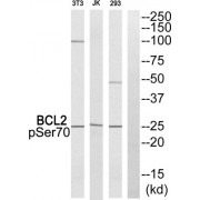 Western blot analysis of extracts from 293 cells. Jurkat cells and NIH/3T3 cells all treated with Paclitaxel, using BCL2 (Phospho-Ser70) antibody.