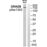 Western blot analysis of extracts from Mouse brain cells, using GRIN2B (Phospho-Ser1303) antibody.