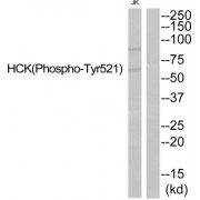 Western blot analysis of extracts from Jurkat cells, using HCK (Phospho-Tyr521) antibody.