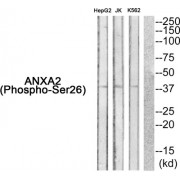 Western blot analysis of extracts from HepG2 cells, JK cells and K562 cells, using ANXA2 (Phospho-Ser26) antibody. The lane on the right is bloced with the synthesized peptide.