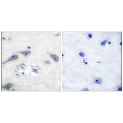 Protein Phosphatase 1 Regulatory Subunit 1B (DARPP-32) Antibody