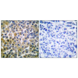 Mothers Against Decapentaplegic Homolog 1 (Smad1) Antibody