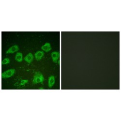 Tyrosine Hydroxylase (TH) Antibody