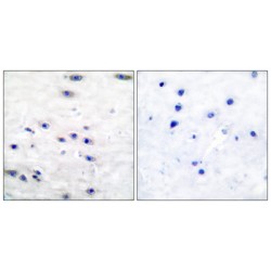 Tyrosine Hydroxylase (TH) Antibody