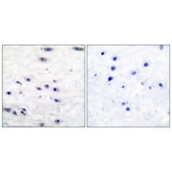 Tyrosine Hydroxylase (TH) Antibody