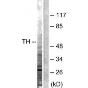 Western blot analysis of extracts from 3T3 cells treated with Forskolin (40nM, 30min), using Tyrosine Hydroxylase antibody (abx012753, Line 1 and 2).
